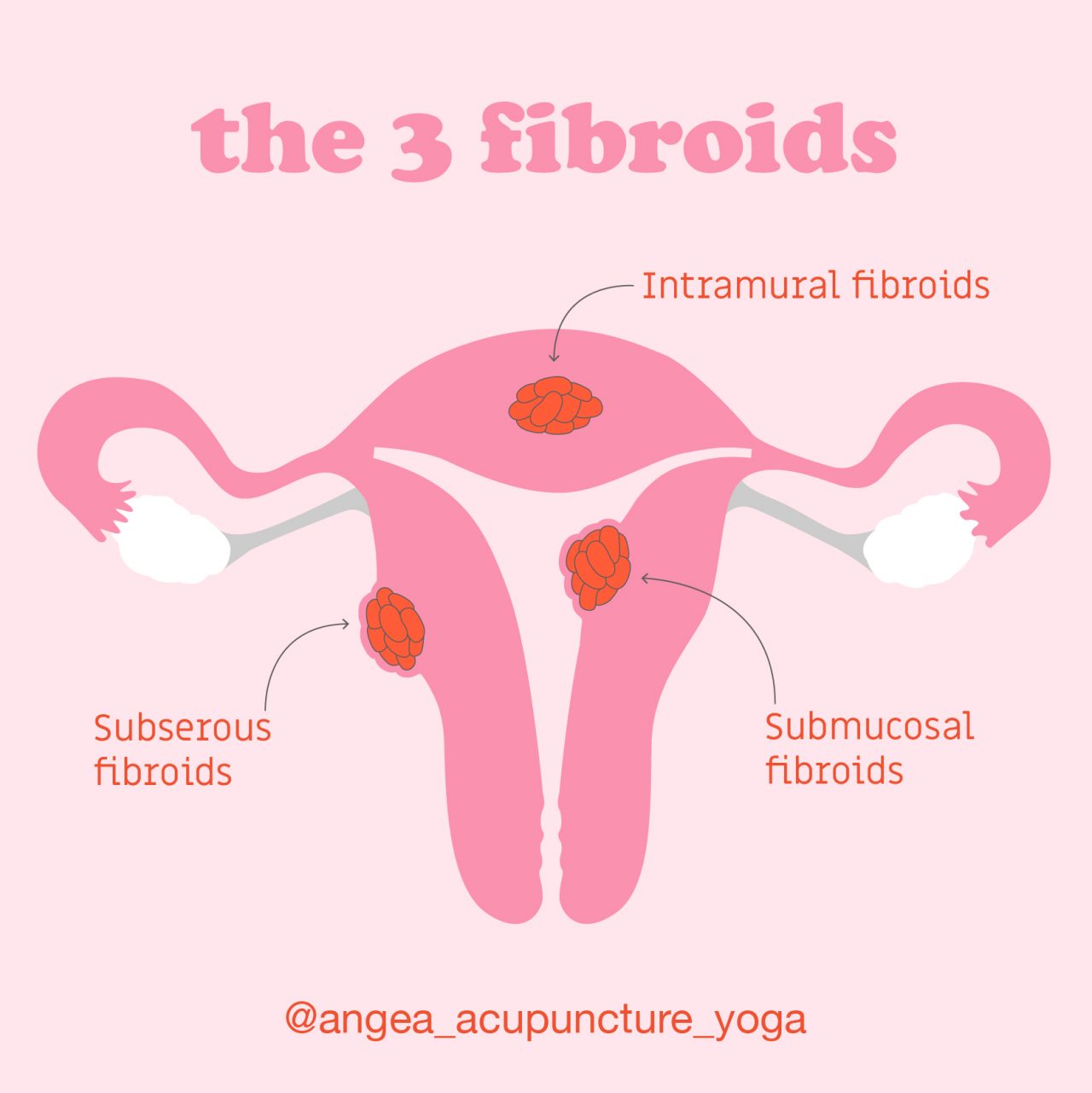What Are Fibroids? - Angea