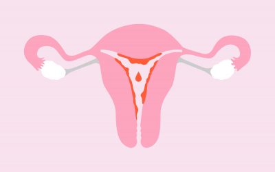Menstrual Blood & Stem Cells