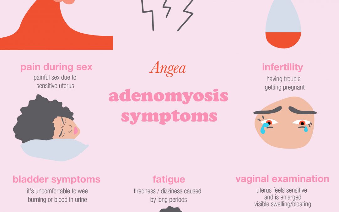 What Is Adenomyosis