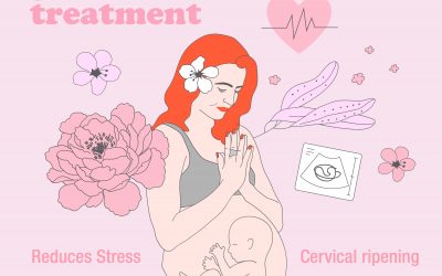 How To Prepare For Birth With Acupuncture