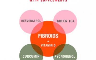 How To Treat Fibroids Naturally